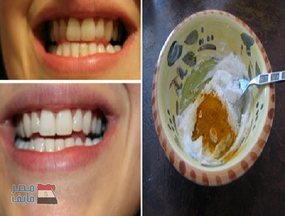 كيفية الحصول على أسنان بيضاء ولامعة باستخدام مكونات طبيعية من المنزل ونتائجها فورية