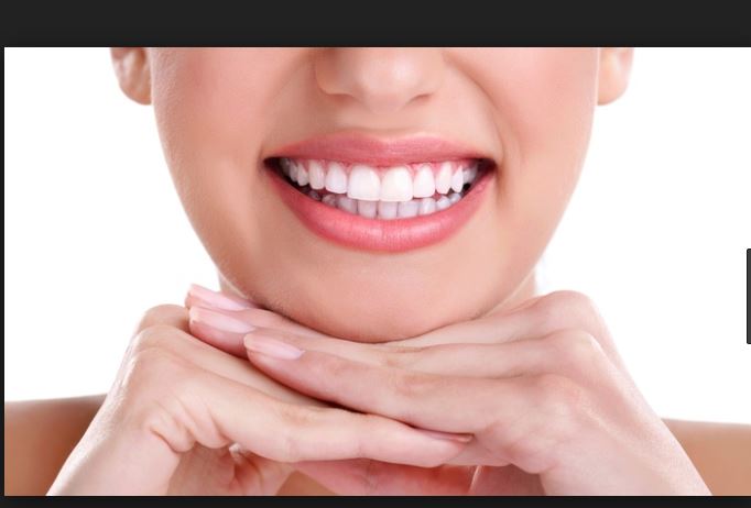 10 معلومات هامة عن تبييض الأسنان عند الطبيب