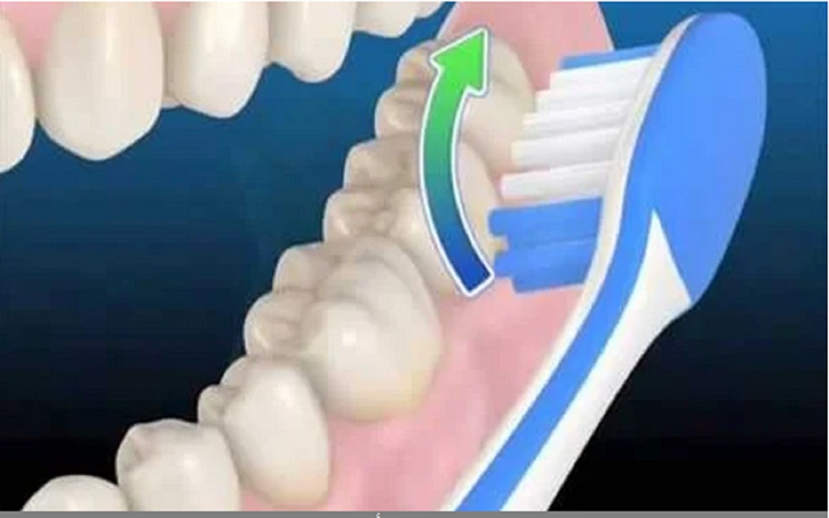 أفضل طرق تبييض الأسنان وعلاج اصفرارها