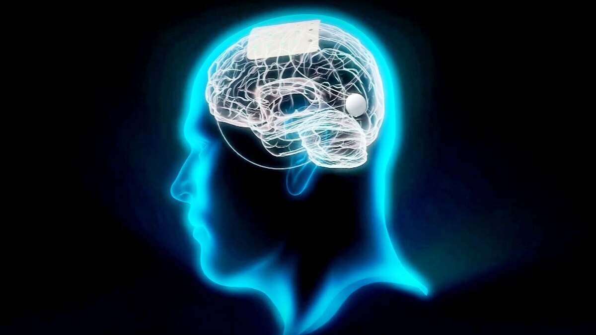 تجربة علمية فريدة| رقائق إلكترونية تزرع بالدماغ وتسمح بالتواصل المباشر مع الكمبيوتر